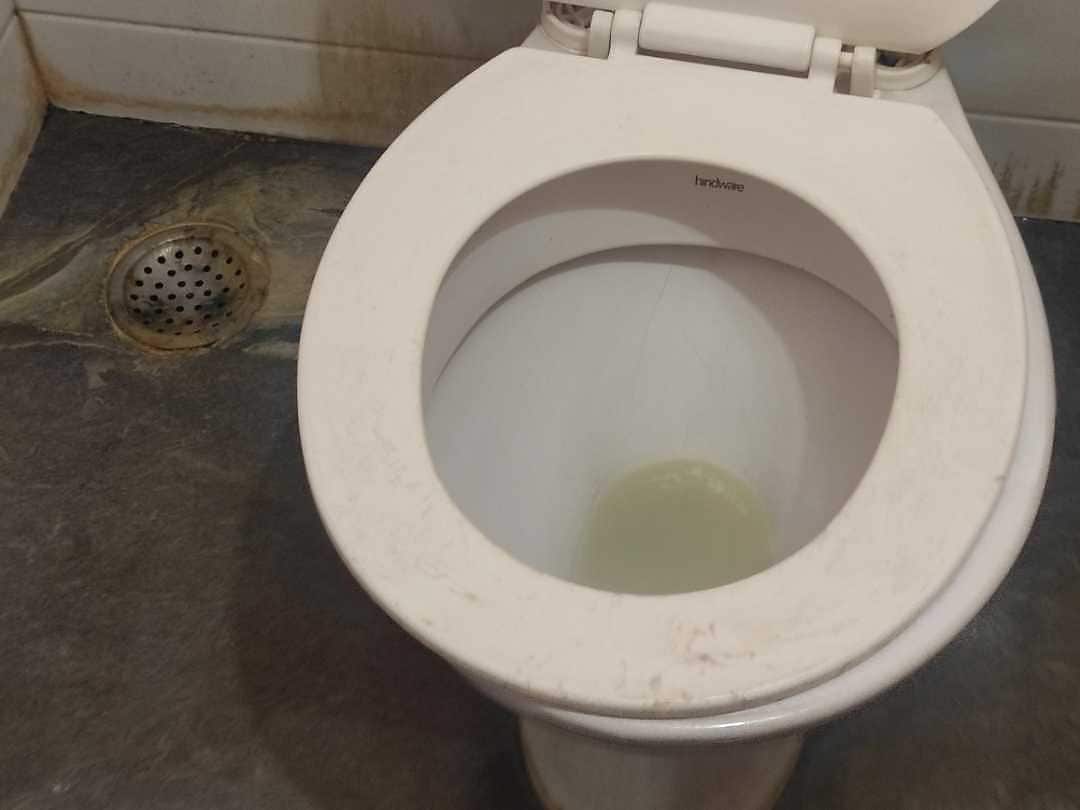 Principal 136+ imagen why is my toilet seat turning blue not pregnant