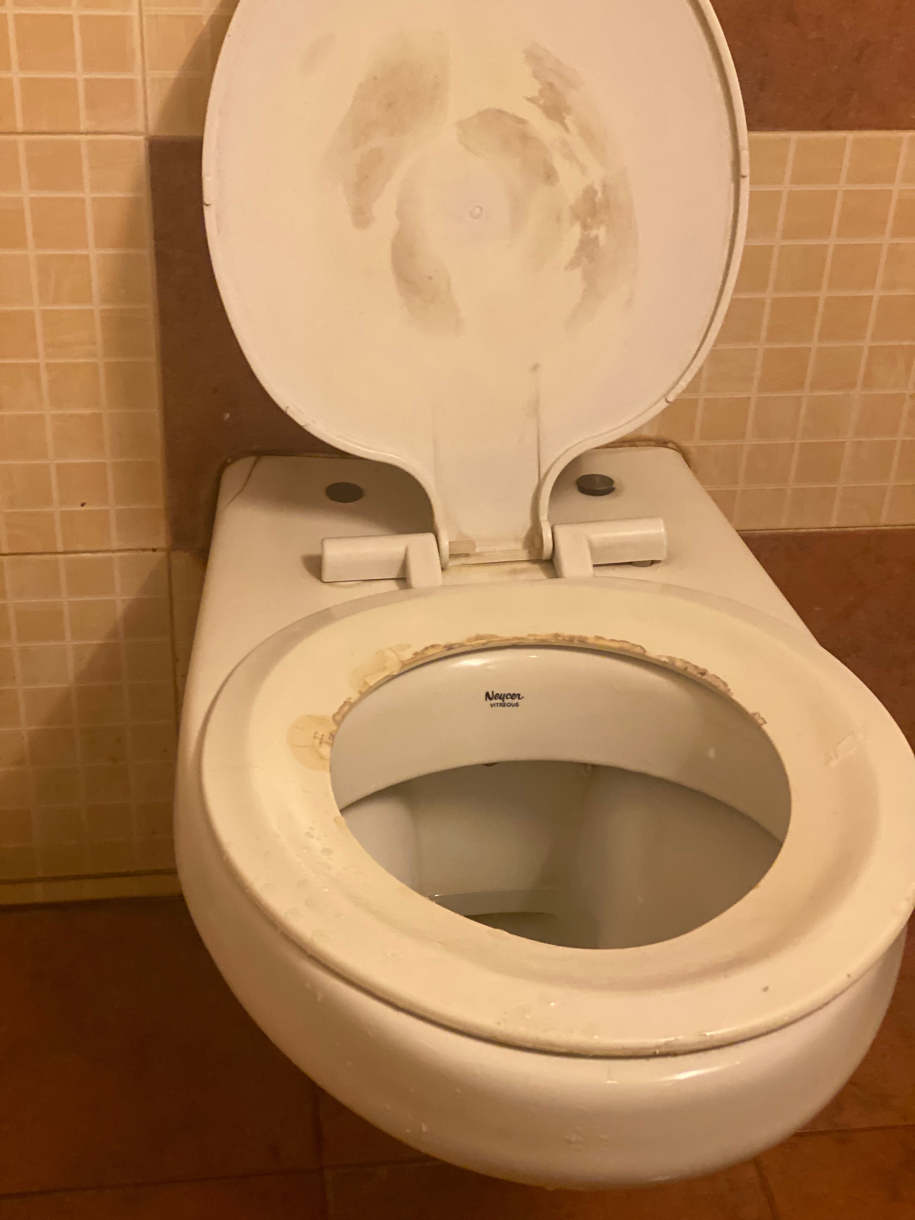 Principal 136+ imagen why is my toilet seat turning blue not pregnant